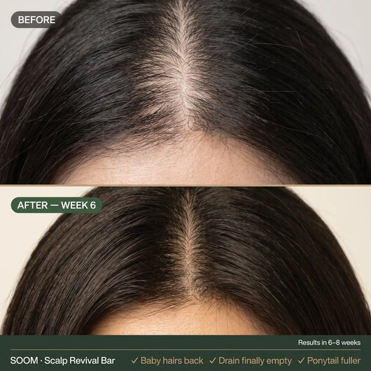SOOM · Korean Scalp Science · 숨