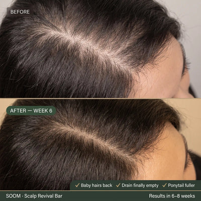 SOOM · Korean Scalp Science · 숨