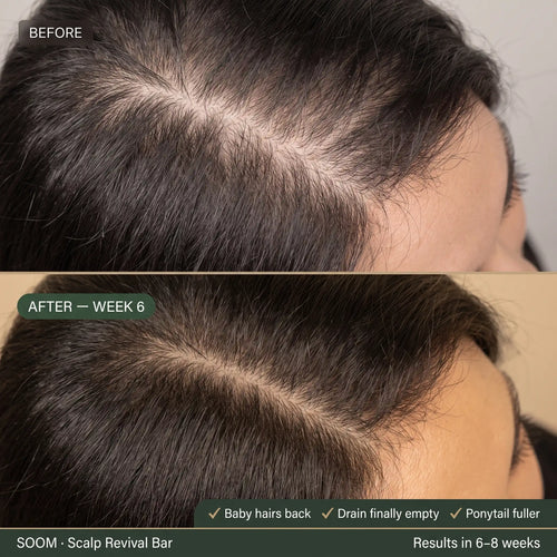 SOOM · Korean Scalp Science · 숨