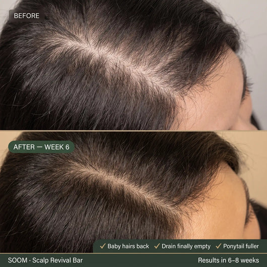 SOOM · Korean Scalp Science · 숨