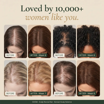 SOOM · Korean Scalp Science · 숨